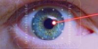 cataract-surgery-img