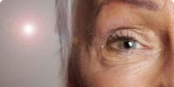 Macular Degeneration Eye Condition