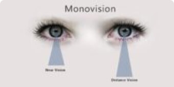 Monovision Eye Condition